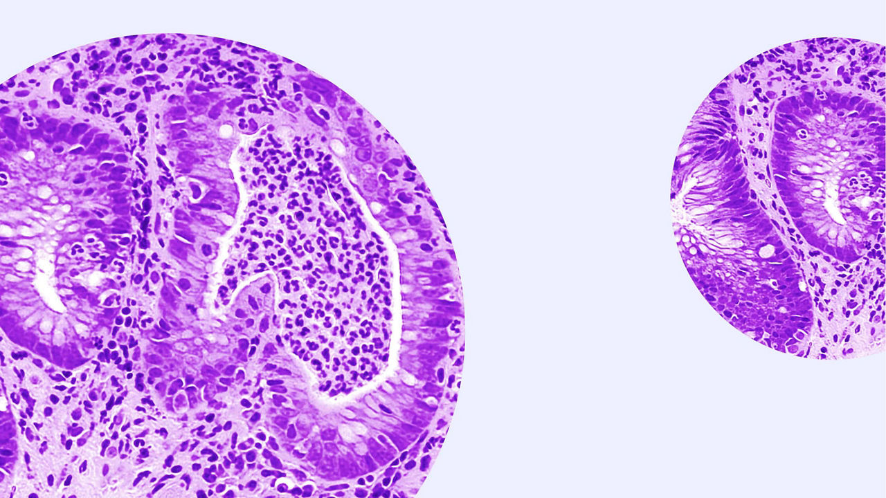 cellules immunologies