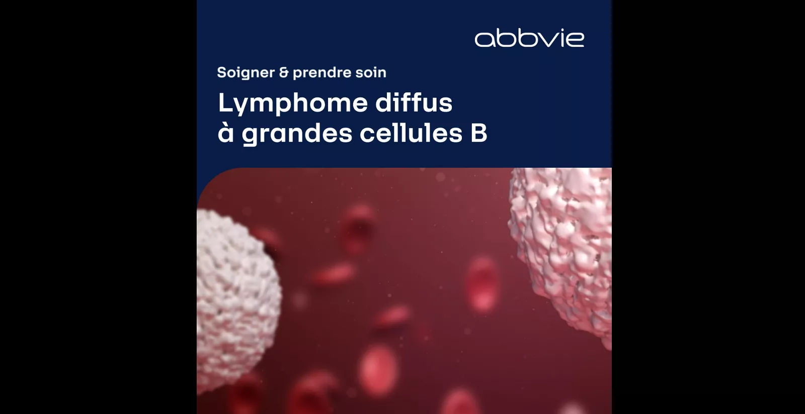 Qu'est-ce qu'une leucémie lymphoïde chronique - vidéo Dr Stéphane Lepretre