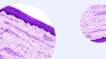 skin cell 