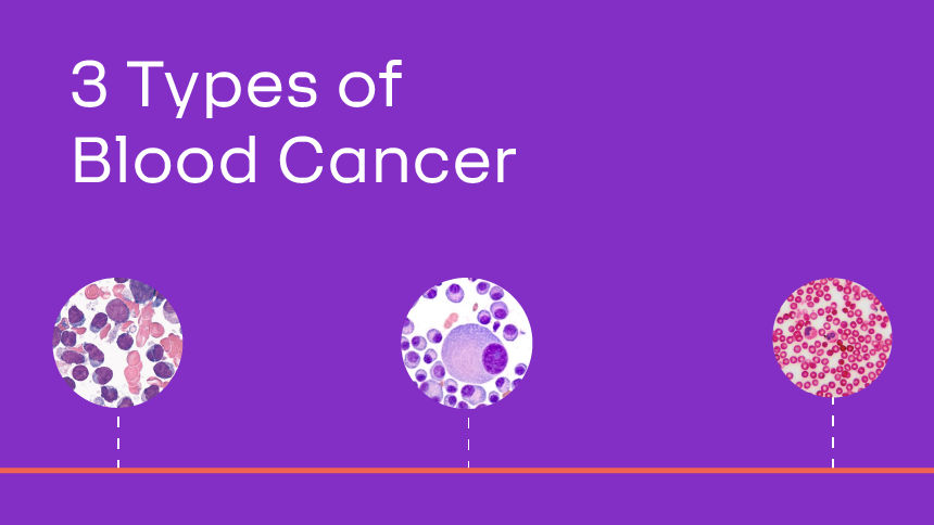  A renaissance in blood cancer treatment