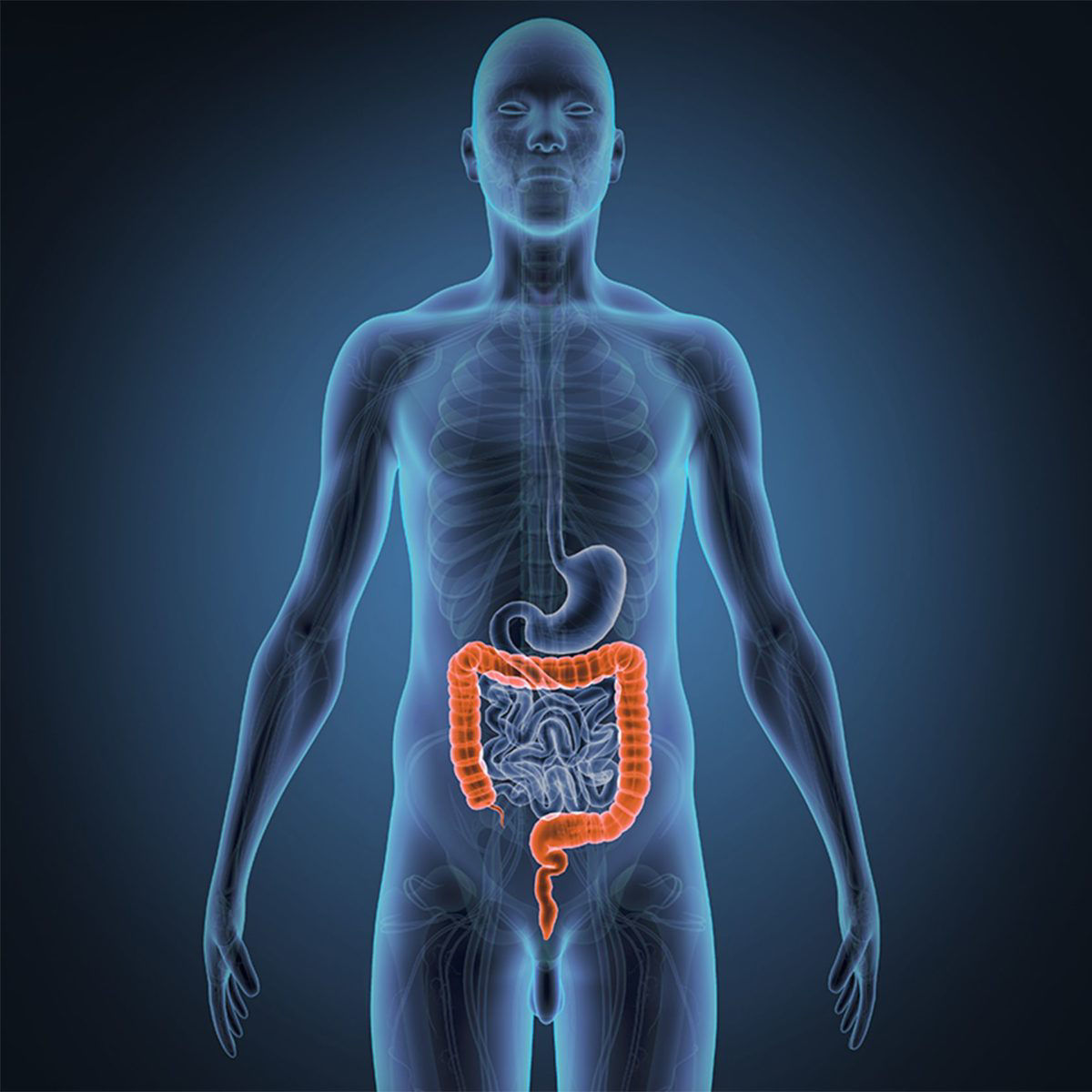 ulcerative-colitis-img